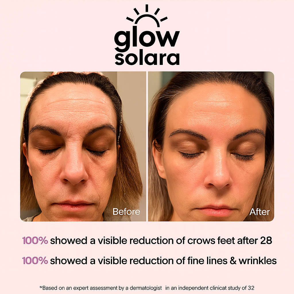 GlowSolara LED Wrinkle Therapy Mask