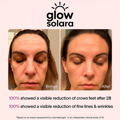 GlowSolara LED Wrinkle Therapy Mask