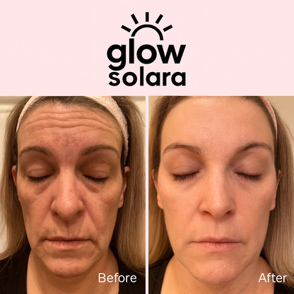 GlowSolara LED Wrinkle Therapy Mask